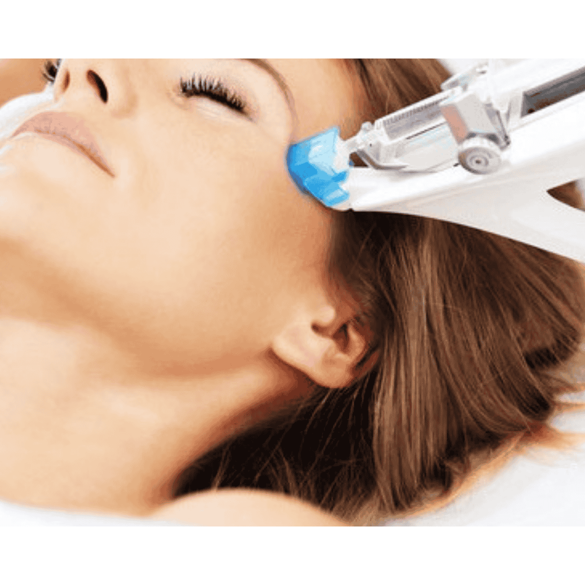 MEOZPTERAIA KOLAGENOW0-NAWILŻAJĄCA z zastosowaniem  Vital injector ( twarz ) (tropokolagen plus kwas hialuronowy)